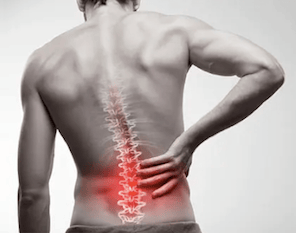 I Hurt My Back — Now What?